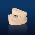 Buong metal casting crown bego